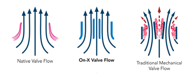 onxlti-valve-comparison onxlti valve comparison Low Anticoagulation Study