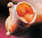 stainless_tissue stainless tissue Heart Valve Disease